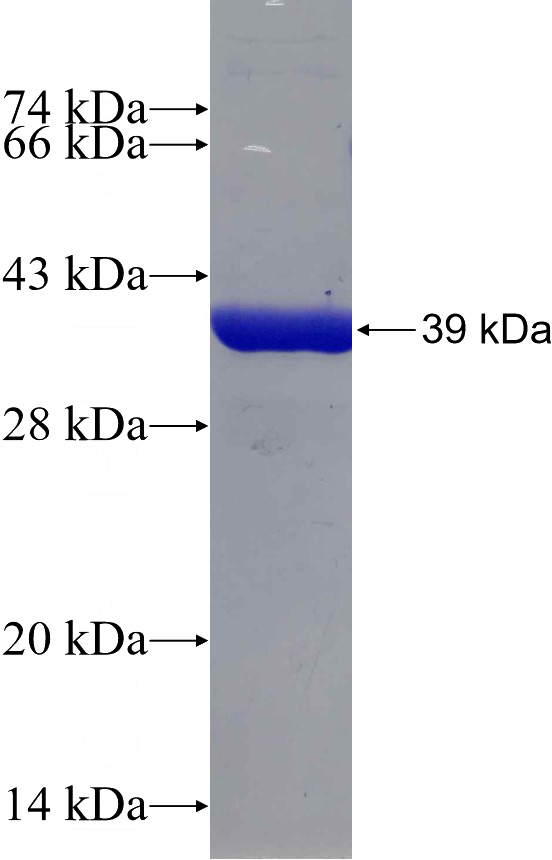 Recombinant Human CARM1 SDS-PAGE