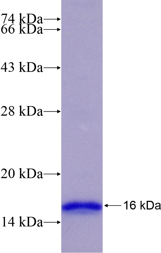 Recombinant Human HOPX SDS-PAGE