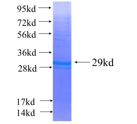 Recombinant human LIN28(Full length) SDS-PAGE