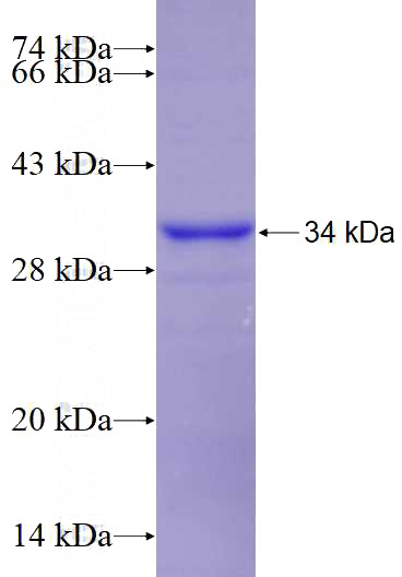 Recombinant Human VDAC3 SDS-PAGE