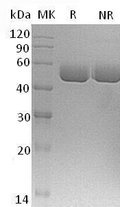 Mouse Serpina1c/Dom3/Dom6/Spi1-3/Spi1-6 (His tag) recombinant protein