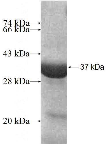 Recombinant Human HLA class I (HLA-C) SDS-PAGE