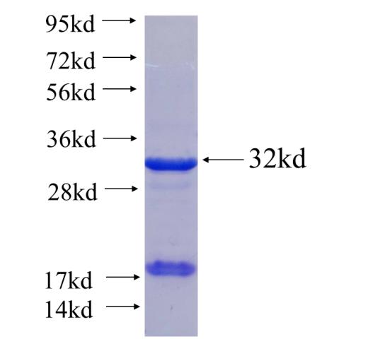 Recombinant human RBM25 SDS-PAGE