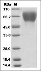 Human FGFR2 / CD332 Protein (His Tag)