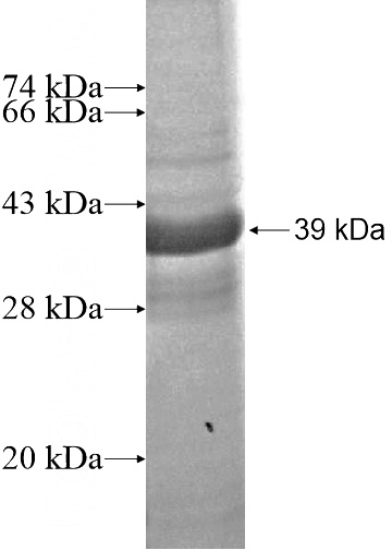 Recombinant Human RASSF3 SDS-PAGE
