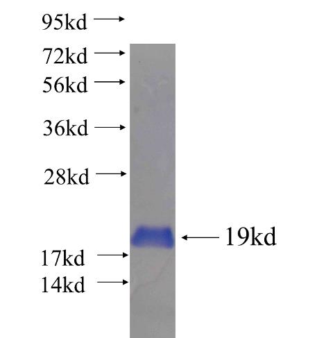 Recombinant human ADAM30 SDS-PAGE