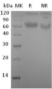 Human IL1RAP/C3orf13/IL1R3 (His tag) recombinant protein