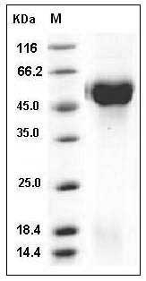 Human ST6GAL1 / CD75 Protein (His Tag) SDS-PAGE