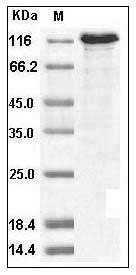 Human Tie2 / CD202b Protein (His & Fc Tag) SDS-PAGE