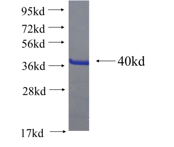 Recombinant human ZNF202 SDS-PAGE