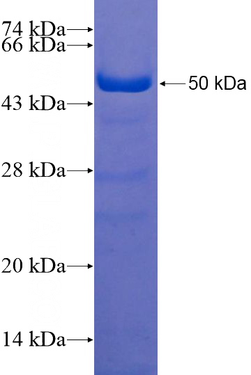 Recombinant Human ZNF318 SDS-PAGE