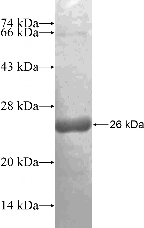 Recombinant Human TBP SDS-PAGE