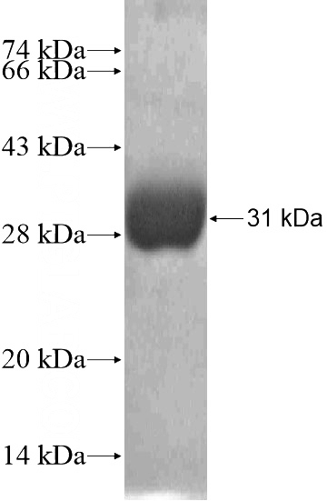 Recombinant Human USE1 SDS-PAGE