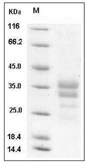 Human IGFBP7 / IBP-7 Protein (His Tag) SDS-PAGE