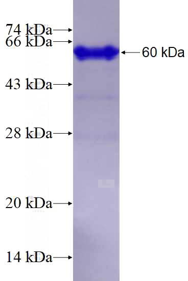 Recombinant Human EEFSEC SDS-PAGE