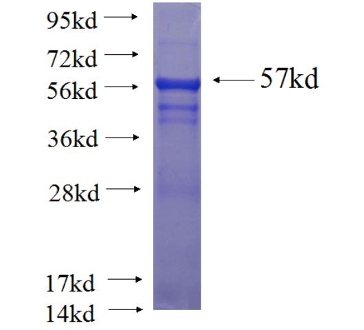 Recombinant human TEX264 SDS-PAGE