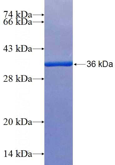 Recombinant Human NKAPL SDS-PAGE