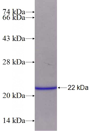 Recombinant Human Huntingtin SDS-PAGE
