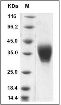 Rat Ephrin-B2 (His Tag) recombinant protein