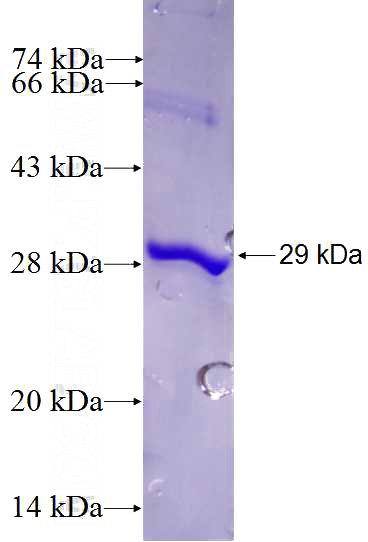 Recombinant Human MYH14 SDS-PAGE