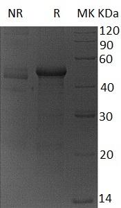 Human PINX1/LPTL/LPTS (His tag) recombinant protein