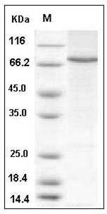 Human STAT4 Protein (His Tag) SDS-PAGE