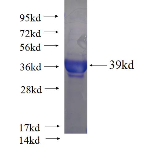 Recombinant human IFLTD1 SDS-PAGE