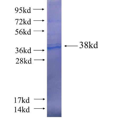Recombinant human CPNE6 SDS-PAGE