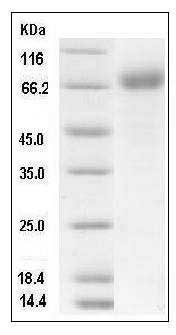 Mouse IL1R1 / CD121a Protein (Fc Tag) SDS-PAGE