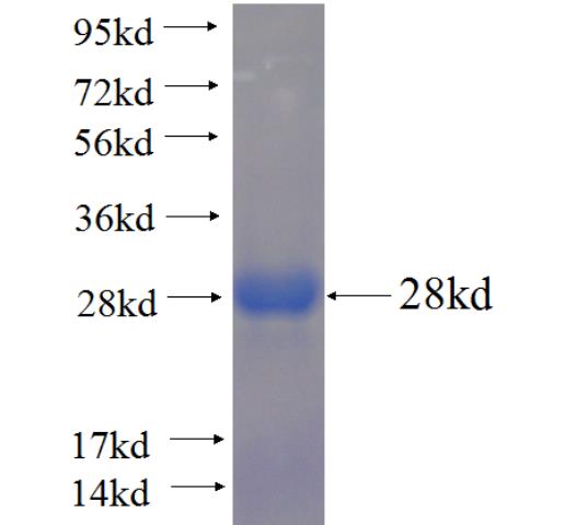 Recombinant human CHGA SDS-PAGE