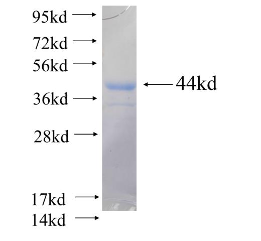 Recombinant human PSMD11 SDS-PAGE