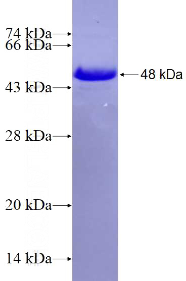 Recombinant Human LAX1 SDS-PAGE