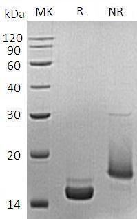 Mouse Pla2g1b/Pla2 (His tag) recombinant protein