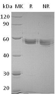 Human MMP1/CLG (His tag) recombinant protein