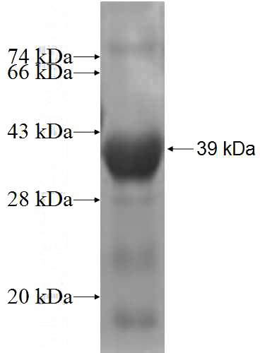 Recombinant Human ACSL6 SDS-PAGE