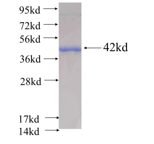 Recombinant human Integrin beta-4 SDS-PAGE