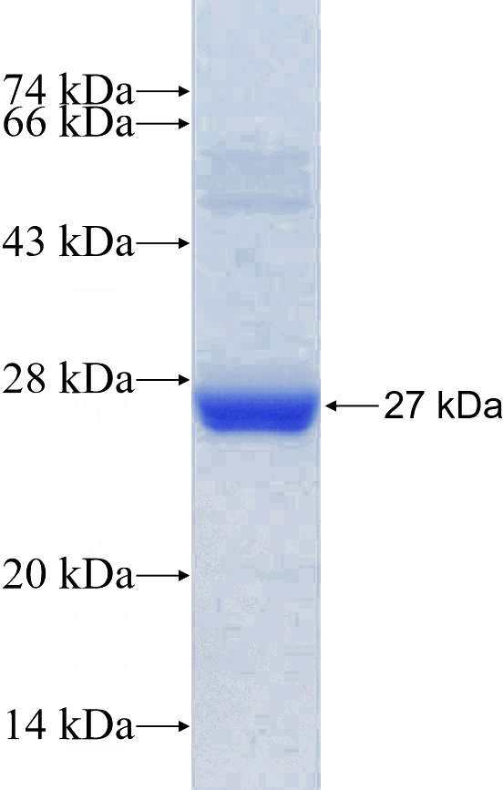 Recombinant Human CIB1 SDS-PAGE
