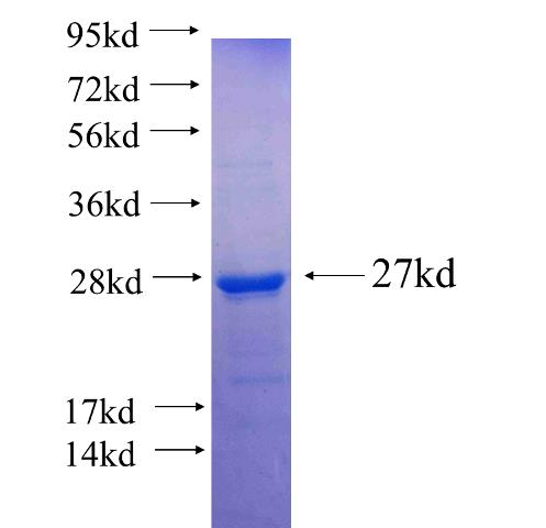 Recombinant human ANAPC11(Full length) SDS-PAGE