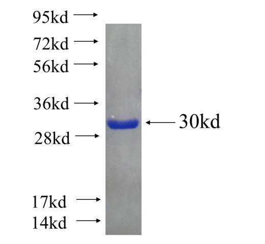 Recombinant human APOL6 SDS-PAGE