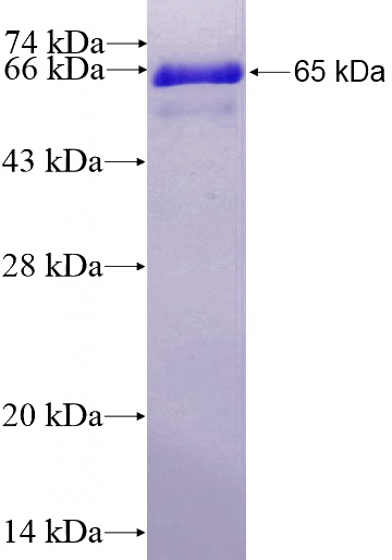 Recombinant Human MYOD1 SDS-PAGE