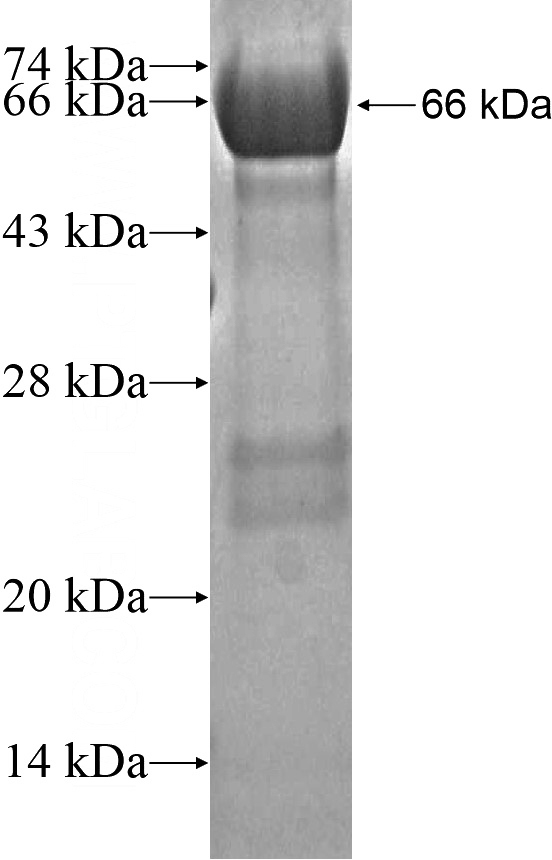 Recombinant Human MYOM1 SDS-PAGE