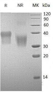 Human IL2RA (His tag) recombinant protein