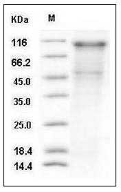 Human KSP-Cadherin / Cadherin-16 / CDH16 Protein (His Tag) SDS-PAGE