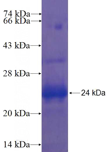 Recombinant Human ZNF623 SDS-PAGE