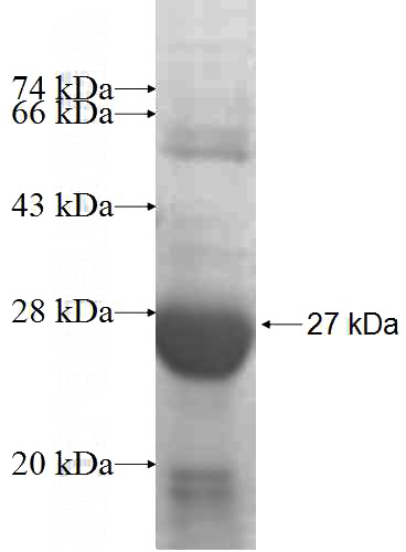 Recombinant Human AMN1 SDS-PAGE
