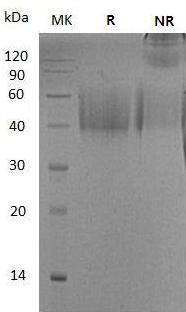Mouse Icoslg/B7h2/B7rp1/Icosl (His tag) recombinant protein