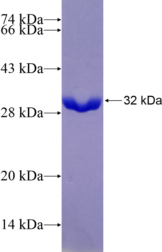 Recombinant Human filamin-c SDS-PAGE