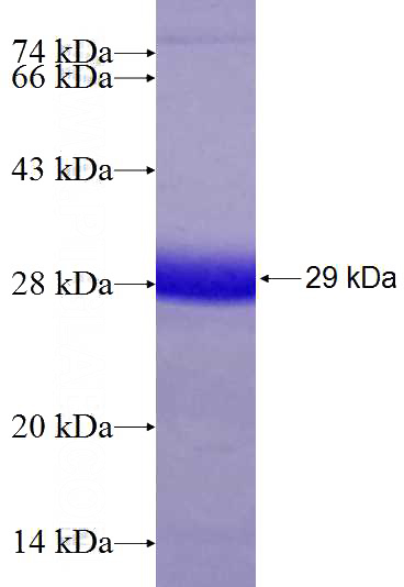 Recombinant Human FADD SDS-PAGE
