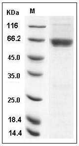 Human CSNK2A1 / CK2A1 Protein (GST Tag) SDS-PAGE