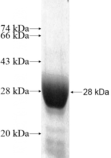 Recombinant Human SLC25A18 SDS-PAGE